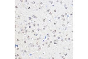 Immunohistochemistry of paraffin-embedded Mouse brain using CNOT7 Rabbit pAb (ABIN6127563, ABIN6138783, ABIN6138784 and ABIN6224834) at dilution of 1:50 (40x lens). (CNOT7 Antikörper  (AA 90-160))