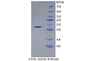 SDS-PAGE (SDS) image for Matrix Metallopeptidase 9 (Gelatinase B, 92kDa Gelatinase, 92kDa Type IV Collagenase) (MMP9) (AA 226-391) protein (His tag) (ABIN1980763)