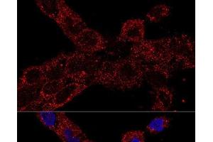 Confocal immunofluorescence analysis of A-431 cells using RPL21 Polyclonal Antibody at dilution of 1:100. (RPL21 Antikörper)