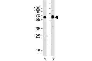 Western Blotting (WB) image for anti-Tyrosine Hydroxylase (TH) (AA 486-514) antibody (ABIN3029766)