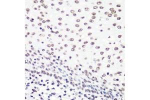Immunohistochemistry (Paraffin-embedded Sections) (IHC (p)) image for anti-Histone H4 (2meLys20) antibody (ABIN3016048)