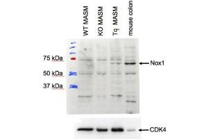 ABIN2564188 (1µg/ml) staining of MASM lysate (35µg protein in RIPA buffer). (NOX1 Antikörper  (Internal Region))