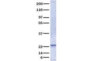 Validation with Western Blot (FGF21 Protein)