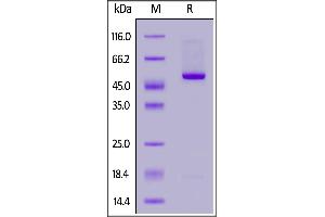 SDS-PAGE (SDS) image for Interleukin 21 (IL21) (AA 30-162) (Active) protein (Fc Tag,AVI tag,Biotin) (ABIN5674598)