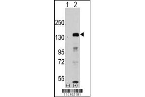 Western blot analysis of JHDM1a/FBXL11 using rabbit polyclonal JHDM1a/FBXL11 Antibody. (KDM2A Antikörper  (AA 500-527))