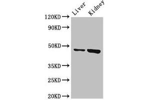 Western Blot Positive WB detected in: Mouse liver tissue, Mouse kidney tissue All lanes: WDFY1 antibody at 3 μg/mL Secondary Goat polyclonal to rabbit IgG at 1/50000 dilution Predicted band size: 47 kDa Observed band size: 47 kDa (WDFY1 Antikörper  (AA 261-357))