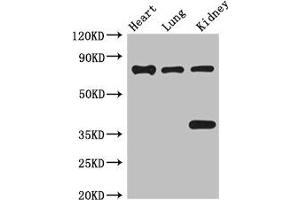 Western Blot Positive WB detected in: Mouse heart tissue, Mouse lung tissue, Mouse kidney tissue All lanes: BRSK1 antibody at 3. (BRSK1 Antikörper  (AA 426-591))