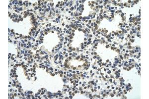 Rabbit Anti-RCOR1 antibody         Paraffin Embedded Tissue:  Human Lung    cell Cellular Data:  alveolar cell    Antibody Concentration:  4.