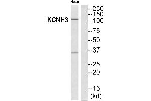 Western blot analysis of extracts from HeLa cells, using KCNH3 antibody. (KCNH3 Antikörper  (Internal Region))