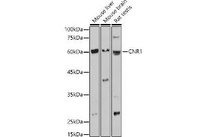 Western blot analysis of extracts of various cell lines, using CNR1 antibody (ABIN1679303, ABIN3015494, ABIN3015496 and ABIN6218536) at 1:1000 dilution. (CNR1 Antikörper  (AA 1-120))
