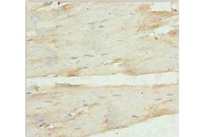 Immunohistochemistry of paraffin-embedded human skeletal muscle tissue using ABIN7144209 at dilution of 1:100 (ANKRD1 Antikörper  (AA 1-130))