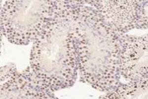 Immunohistochemistry analysis of paraffin-embedded mouse testis using,TADA2B (ABIN7075957) at dilution of 1: 3200 (TADA2B Antikörper)