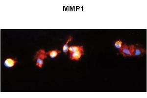 Immunohistochemistry (IHC) image for anti-Matrix Metallopeptidase 1 (Interstitial Collagenase) (MMP1) (C-Term) antibody (ABIN2777120)
