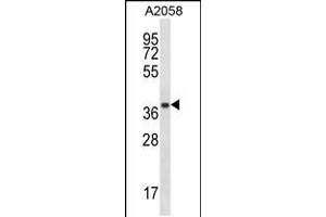 Western blot analysis in A2058 cell line lysates (35ug/lane).