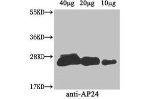 Western Blot Positive WB detected in: Nicotiana tabacum (40 μg, 20 μg, 10 μg) All lanes: AP24 antibody at 3 μg/mL Secondary Goat polyclonal to rabbit IgG at 1/50000 dilution Predicted band size: 27 kDa Observed band size: 27 kDa (AP24 (AA 22-246) Antikörper)