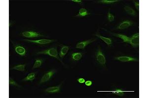 Immunofluorescence of purified MaxPab antibody to EPHX1 on HeLa cell. (EPHX1 Antikörper  (AA 1-455))