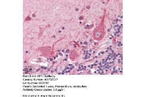 Immunohistochemistry with Human Braun, cerebellum tissue at an antibody concentration of 5.
