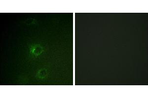Peptide - +Immunofluorescence analysis of COS7 cells, using CBL (Ab-700) antibody. (CBL Antikörper  (Tyr700))
