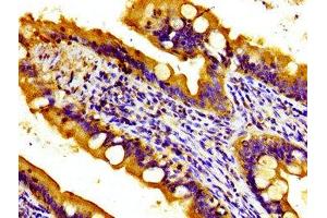 Immunohistochemistry of paraffin-embedded human small intestine tissue using ABIN7166191 at dilution of 1:100 (Protein Tob1 (TOB1) (AA 42-175) Antikörper)