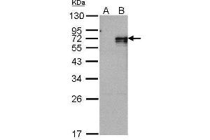 WB Image Western Blot analysis of NR4A1 expression in transfected 293T cell line by NR4A1 polyclonal antibody. (NR4A1 Antikörper  (C-Term))