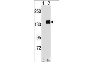 Western blot analysis of PUM1 (arrow) using PUM1 Antibody (Y83) (ABIN391822 and ABIN2841668). (PUM1 Antikörper  (AA 62-91))