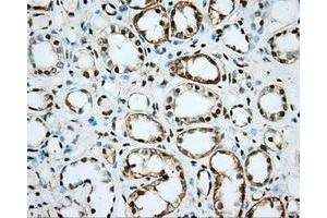 Immunohistochemical staining of paraffin-embedded Kidney tissue using anti-NME4 mouse monoclonal antibody. (NME4 Antikörper)