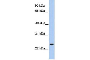 ORAI1 antibody used at 1 ug/ml to detect target protein.