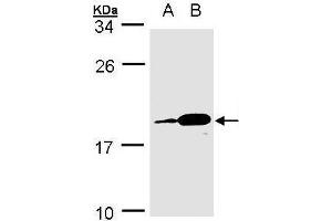 WB Image Sample(30 ug whole cell lysate) A:MOLT4 , B:Raji , 15% SDS PAGE antibody diluted at 1:1000 (MZB1 Antikörper)