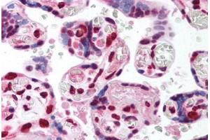 Human Placenta (formalin-fixed, paraffin-embedded) stained with TCF4 antibody ABIN214151 at 5 ug/ml followed by biotinylated goat anti-rabbit IgG secondary antibody ABIN481713, alkaline phosphatase-streptavidin and chromogen. (TCF4 Antikörper  (AA 73-122))