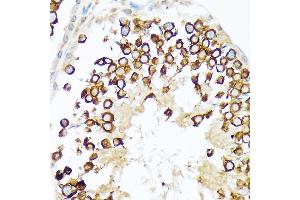 Immunohistochemistry (IHC) image for anti-Calmegin (CLGN) antibody (ABIN7266026)
