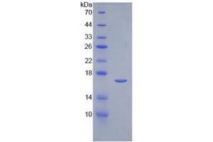SDS-PAGE of Protein Standard from the Kit (Highly purified E. (IL-2 CLIA Kit)