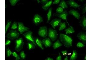 Immunofluorescence (IF) image for anti-Phosphoglucomutase 1 (PGM1) (AA 1-562) antibody (ABIN562198)