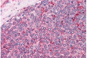 Human Spleen: Formalin-Fixed, Paraffin-Embedded (FFPE) (Calnexin Antikörper  (AA 109-274))