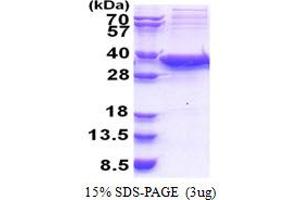 SDS-PAGE (SDS) image for Sirtuin 5 (SIRT5) (AA 34-310) protein (His tag) (ABIN5853379)