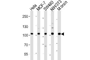 Western blot analysis of lysates from Hela, MCF-7, S, mouse NIH/3T3 cell line, mouse brain tissue lysate (from left to right), using EPHA4 Antibody (Center) (ABIN6243785 and ABIN6577670). (EPH Receptor A4 Antikörper  (AA 383-417))