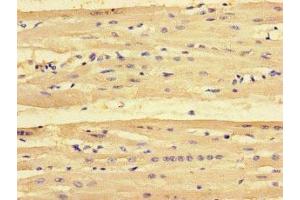 Immunohistochemistry of paraffin-embedded human heart tissue using ABIN7163088 at dilution of 1:100