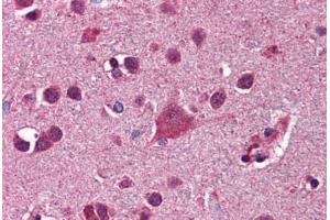 Human Brain, Cortex: Formalin-Fixed, Paraffin-Embedded (FFPE) (FKBP5 Antikörper  (AA 326-375))