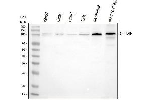 Western blot analysis of COMP using anti-COMP antibody (ABIN6719297).