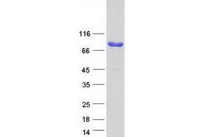 Validation with Western Blot (Scinderin Protein (SCIN) (Transcript Variant 2) (Myc-DYKDDDDK Tag))