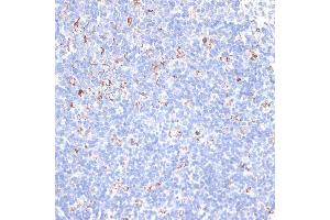 Immunohistochemistry of paraffin-embedded mouse spleen using KCNS3 antibody (ABIN6132153, ABIN6142774, ABIN6142775 and ABIN6223897) at dilution of 1:100 (40x lens). (KCNS3 Antikörper  (AA 1-180))