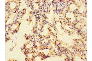 Immunohistochemistry of paraffin-embedded human lung tissue using ABIN7170239 at dilution of 1:100 (SLC35F6 Antikörper  (AA 337-371))
