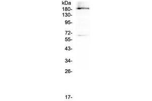 Western blot testing of human U937 cell lysate with Dnmt1 antibody at 0. (DNMT1 Antikörper)