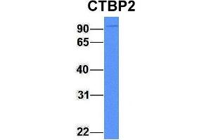 Western Blotting (WB) image for anti-C-terminal Binding Protein 2 (CTBP2) (C-Term) antibody (ABIN2784279)