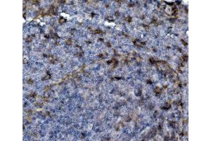 IHC analysis of SELPLG using anti-SELPLG antibody (ABIN7600337).