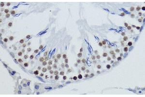 Immunohistochemistry of paraffin-embedded Rat testis using DiMethyl-Histone H4-K20 Polyclonal Antibody at dilution of 1:200 (40x lens). (Histone H4 Antikörper  (2meLys20))