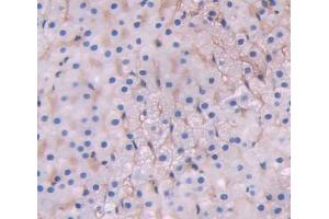 Used in DAB staining on fromalin fixed paraffin- embedded adrenal gland tissue (ABCD1 Antikörper  (AA 102-386))
