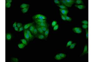 Immunofluorescence staining of HepG2 cells with ABIN7154867 at 1:66, counter-stained with DAPI. (HSP70 1A Antikörper  (AA 418-512))