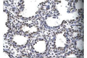 Rabbit Anti-MYEF2 Antibody       Paraffin Embedded Tissue:  Human alveolar cell   Cellular Data:  Epithelial cells of renal tubule  Antibody Concentration:   4. (MYEF2 Antikörper  (Middle Region))