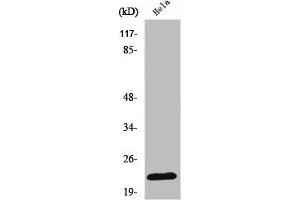 Western Blot analysis of COLO205 cells using Ribosomal Protein L18 Polyclonal Antibody (RPL18 Antikörper  (Internal Region))