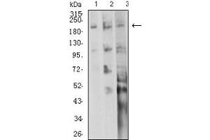 Western Blotting (WB) image for anti-Integrin beta 4 (ITGB4) (AA 29-206) antibody (ABIN5611133)